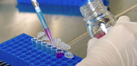 Un laboratoire israélien d’innovation biotechnologique entend générer des anticorps à l’aide de l’IA